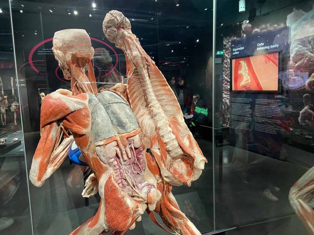 Body Worlds